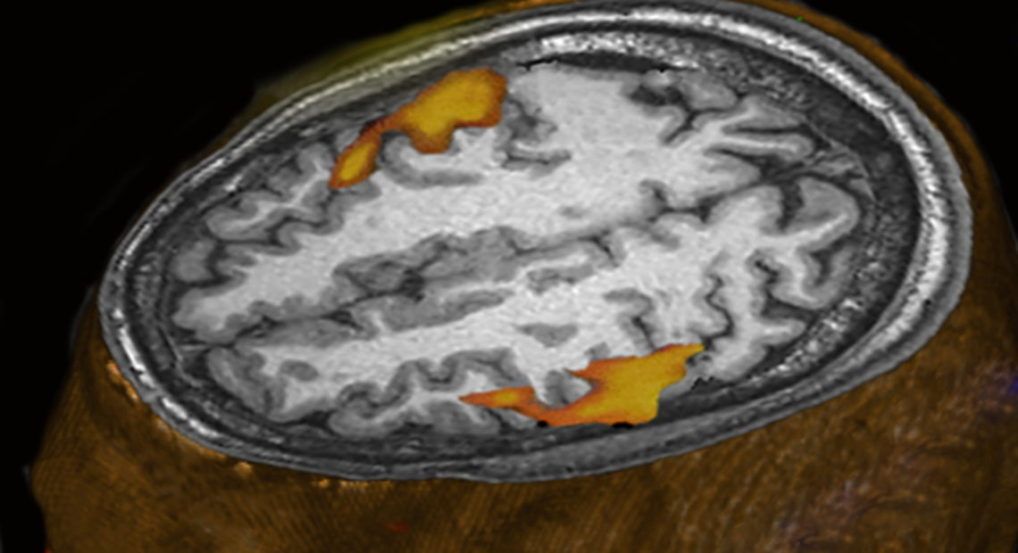 An MRI scan of a person listening to music shows brain areas that respond. (This scan wasn't part of the research comparing humans and monkeys.) KUL BHATIA/Kul Bhatia/Science Source