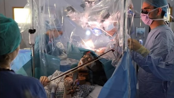 Dagmar Turner recently played her violin during brain surgery in London. "The violin is my passion," she said in a statement. "I've been playing since I was 10 years old." King's College Hospital NHS Foundation Trust/Screen shot by NPR