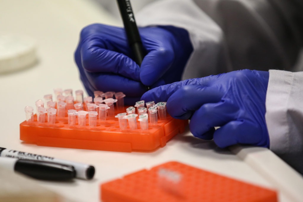 A scientist at work on a COVID-19 vaccine candidate at Bogazici University in Istanbul in August. Onur Coban/Anadolu Agency via Getty Images