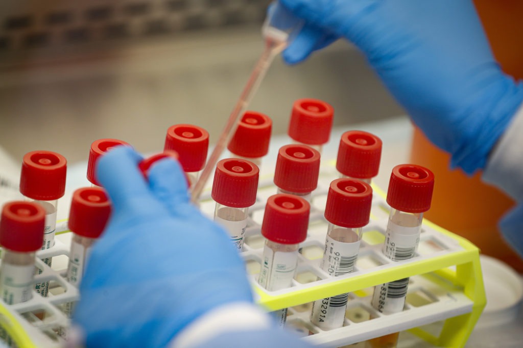 A technician prepares coronavirus test samples on New York's Long Island. The head of New York City's public labs said fighting the virus without a test was like building a house with a saw but no hammer. CREDIT: John Minchillo/AP