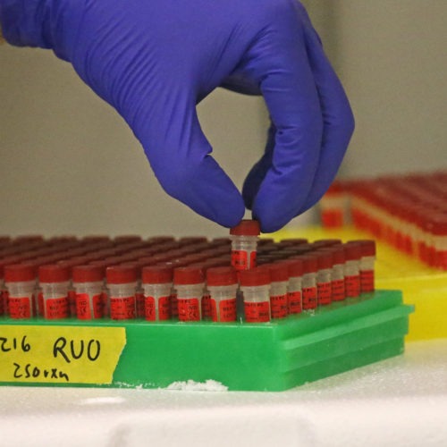 A lab gloved hand taking samples out of a batch of covid test tubes