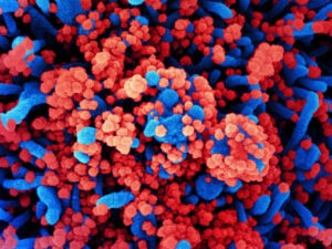 SARS-CoV-2 virus particles, shown in red, have heavily infected a cell in this colorized scanning electron micrograph. SARS-CoV-2 is the virus that causes COVID-19. NIAID/NIH/Flickr