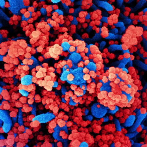 SARS-CoV-2 virus particles, shown in red, have heavily infected a cell in this colorized scanning electron micrograph. SARS-CoV-2 is the virus that causes COVID-19. NIAID/NIH/Flickr