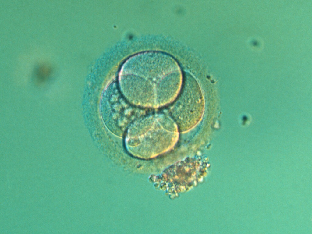 Four-cell embryo. Light micrograph of the blastomeres of a four-cell human embryo. The blastomeres are the rounded cells, here formed after two divisions of the fertilized egg. An envelope, the zona pellucida, is seen surrounding the embryo, and the heads of some sperm are visible still attached to it. The fertilized ovum is composed of a single cell, the zygote, containing the genetic material of both spermatozoid and ovum. It then divides repeatedly, producing a cluster of cells that embed themselves in the uteral lining. During the first 8 weeks the child in the womb is called an embryo. At the 2 or 4-cell stage, embryos produced by in vitro fertilization are either embedded in the uterus or frozen for later introduction.