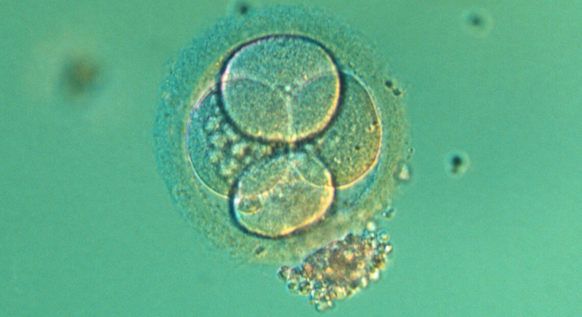 Four-cell embryo. Light micrograph of the blastomeres of a four-cell human embryo. The blastomeres are the rounded cells, here formed after two divisions of the fertilized egg. An envelope, the zona pellucida, is seen surrounding the embryo, and the heads of some sperm are visible still attached to it. The fertilized ovum is composed of a single cell, the zygote, containing the genetic material of both spermatozoid and ovum. It then divides repeatedly, producing a cluster of cells that embed themselves in the uteral lining. During the first 8 weeks the child in the womb is called an embryo. At the 2 or 4-cell stage, embryos produced by in vitro fertilization are either embedded in the uterus or frozen for later introduction.