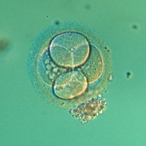 Four-cell embryo. Light micrograph of the blastomeres of a four-cell human embryo. The blastomeres are the rounded cells, here formed after two divisions of the fertilized egg. An envelope, the zona pellucida, is seen surrounding the embryo, and the heads of some sperm are visible still attached to it. The fertilized ovum is composed of a single cell, the zygote, containing the genetic material of both spermatozoid and ovum. It then divides repeatedly, producing a cluster of cells that embed themselves in the uteral lining. During the first 8 weeks the child in the womb is called an embryo. At the 2 or 4-cell stage, embryos produced by in vitro fertilization are either embedded in the uterus or frozen for later introduction.